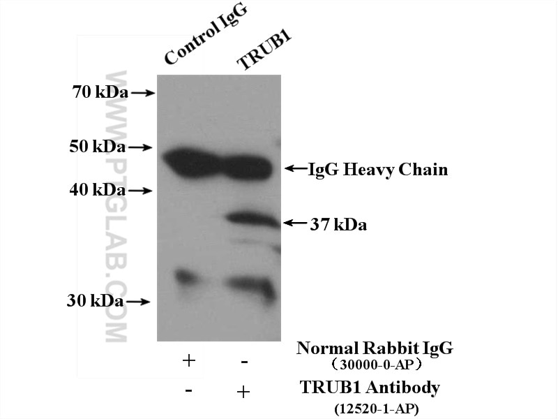 Immunoprecipitation (IP) experiment of mouse liver tissue using TRUB1 Polyclonal antibody (12520-1-AP)