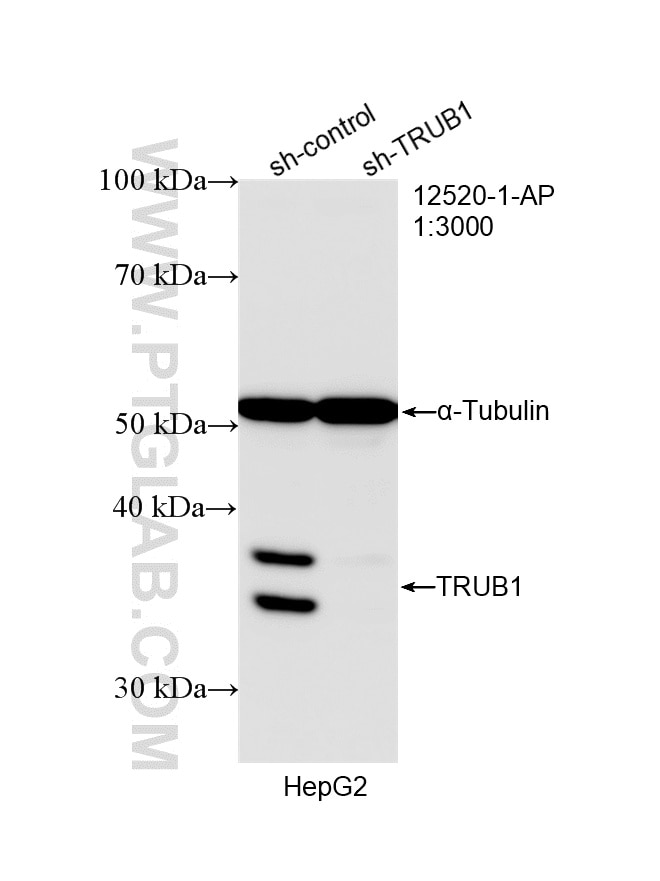 Western Blot (WB) analysis of HepG2 cells using TRUB1 Polyclonal antibody (12520-1-AP)