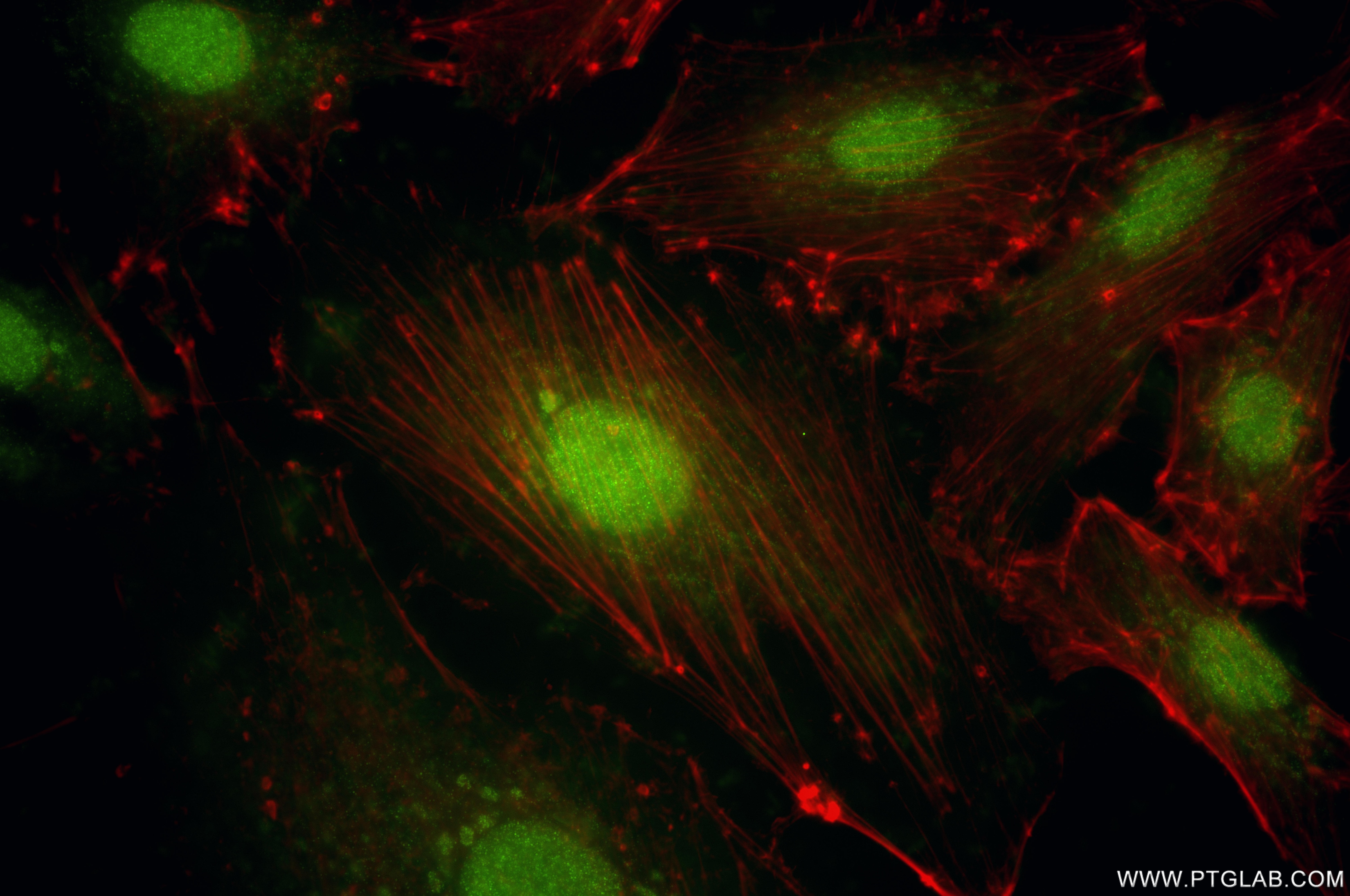 Immunofluorescence (IF) / fluorescent staining of A549 cells using TRUB1 Recombinant monoclonal antibody (85746-1-RR)