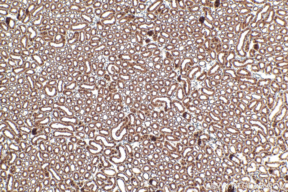 Immunohistochemical analysis of paraffin-embedded mouse kidney tissue slide using RMX00073 (TRUB1 antibody) at dilution of 1:500 (under 10x lens). Heat mediated antigen retrieval with Tris-EDTA buffer (pH 9.0). Immunohistochemistry (IHC) staining of mouse kidney tissue using Multi-rAb® TRUB1 Multi-Recombinant antibody (RMX00073)