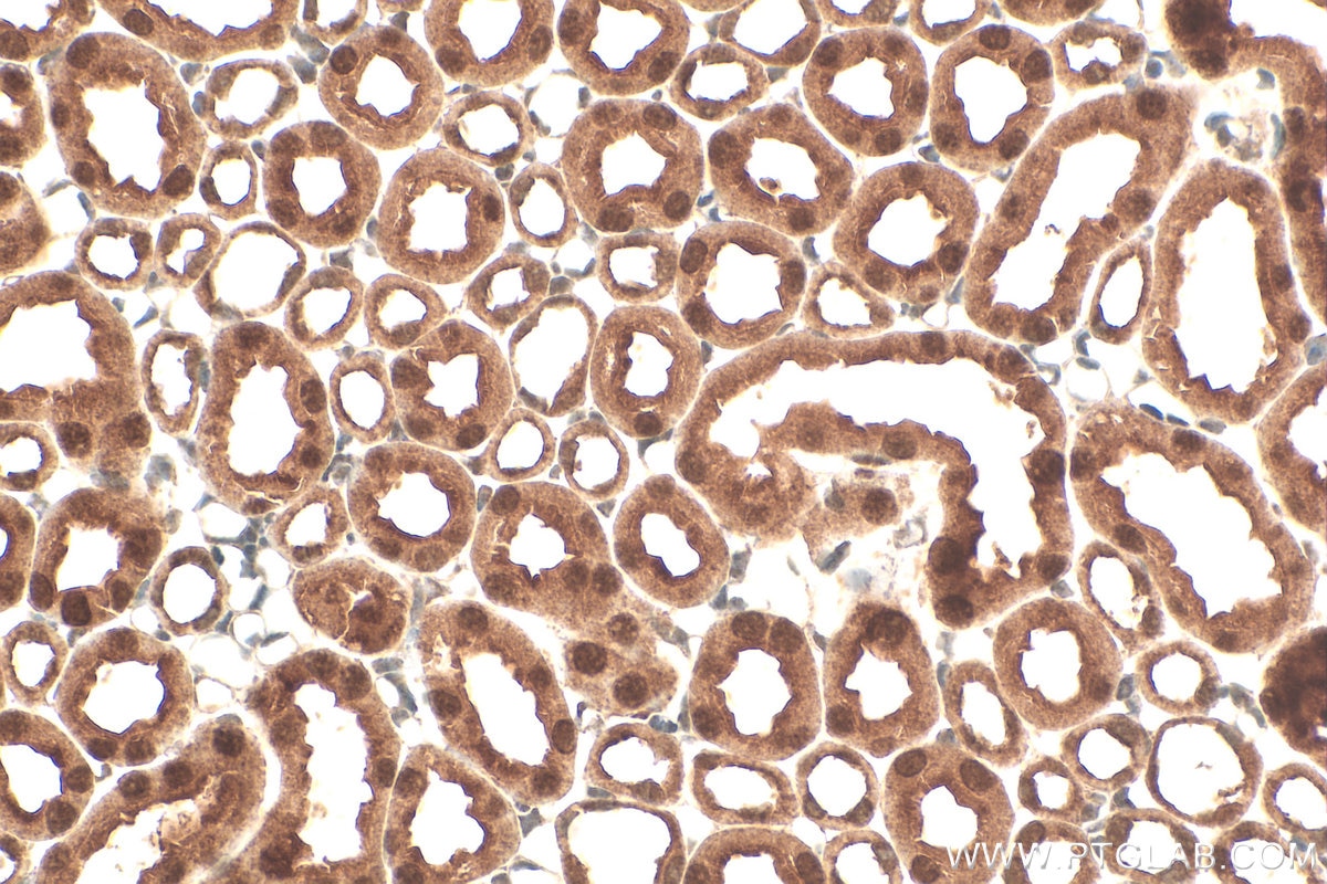 Immunohistochemical analysis of paraffin-embedded mouse kidney tissue slide using RMX00073 (TRUB1 antibody) at dilution of 1:500 (under 40x lens). Heat mediated antigen retrieval with Tris-EDTA buffer (pH 9.0). Immunohistochemistry (IHC) staining of mouse kidney tissue using Multi-rAb® TRUB1 Multi-Recombinant antibody (RMX00073)
