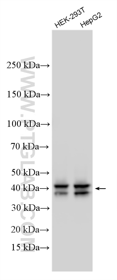 Various lysates were subjected to SDS PAGE followed by western blot with RMX00073 (TRUB1 antibody) at dilution of 1:6000 incubated at room temperature for 1.5 hours. Western Blot (WB) analysis of various lysates using Multi-rAb® TRUB1 Multi-Recombinant antibody (RMX00073)