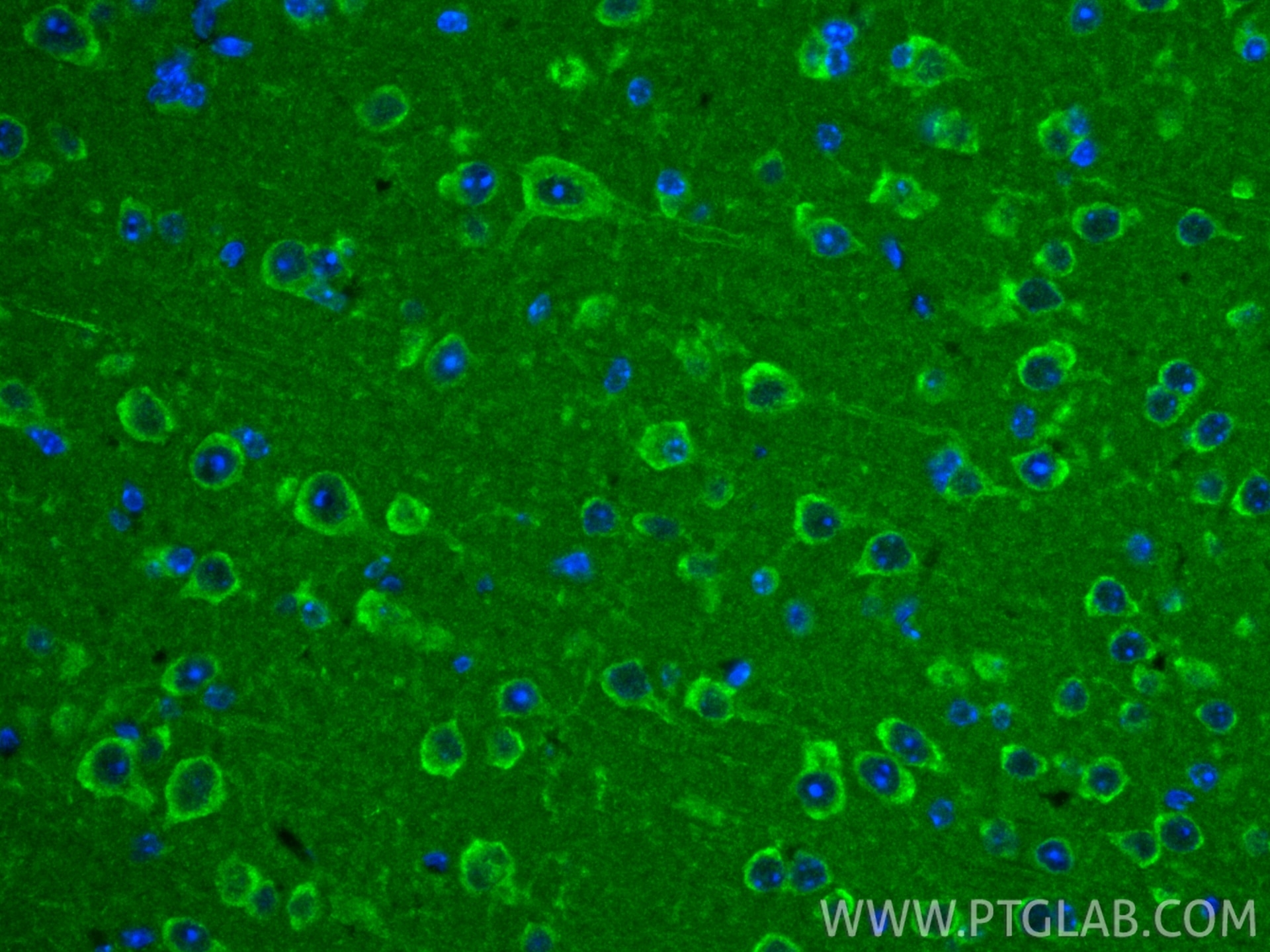 Immunofluorescence (IF) / fluorescent staining of mouse brain tissue using TRUB2 Polyclonal antibody (19891-1-AP)