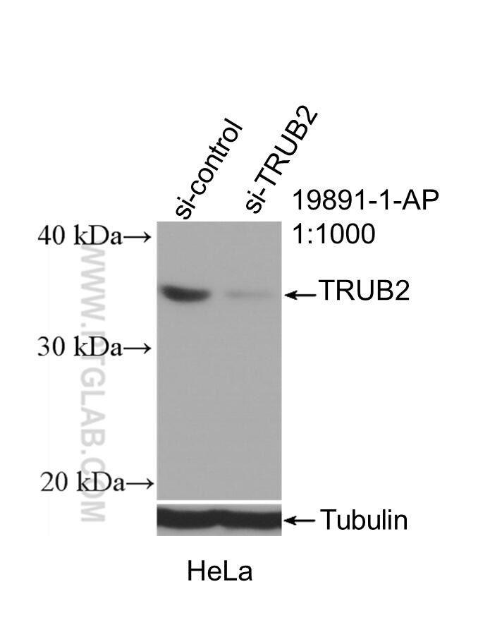 Western Blot (WB) analysis of HeLa cells using TRUB2 Polyclonal antibody (19891-1-AP)