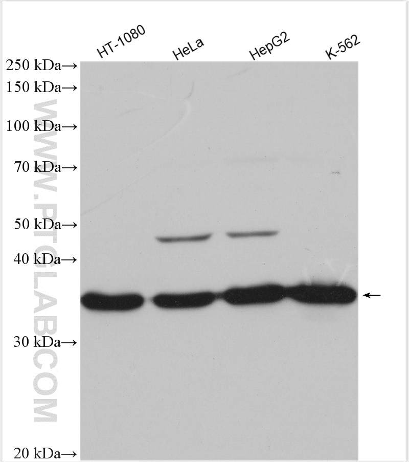 Western Blot (WB) analysis of various lysates using TRUB2 Polyclonal antibody (19891-1-AP)