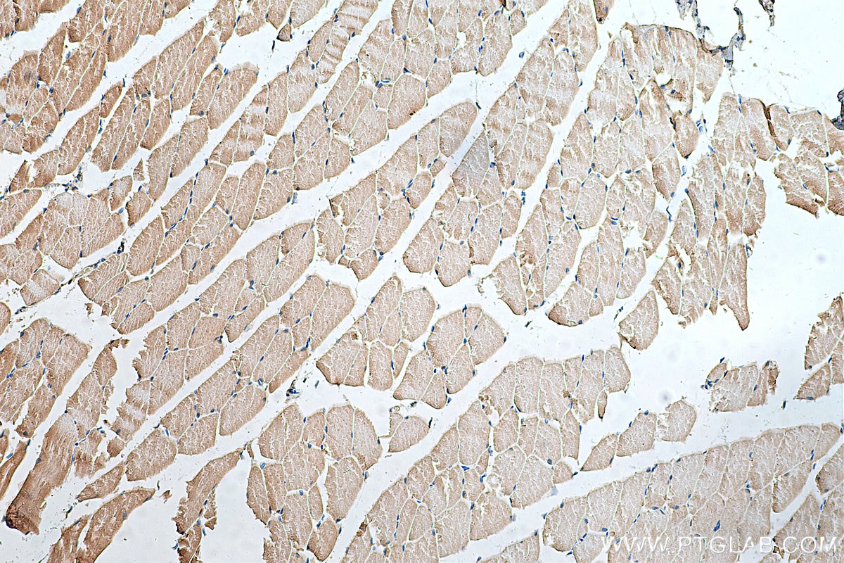 Immunohistochemistry (IHC) staining of mouse skeletal muscle tissue using Hamartin/TSC1 Polyclonal antibody (29906-1-AP)