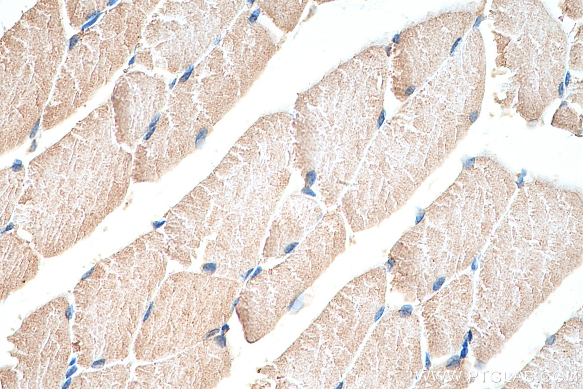 Immunohistochemistry (IHC) staining of mouse skeletal muscle tissue using Hamartin/TSC1 Polyclonal antibody (29906-1-AP)