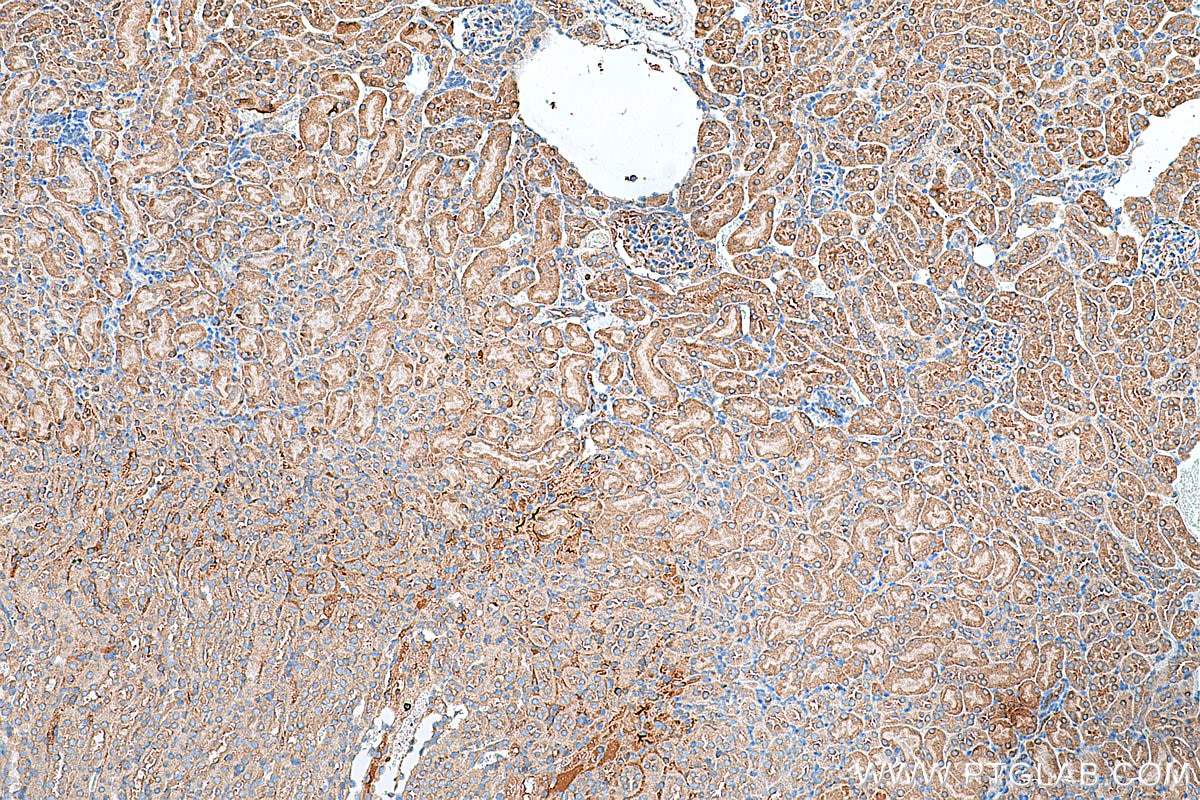 Immunohistochemistry (IHC) staining of mouse kidney tissue using Hamartin/TSC1 Polyclonal antibody (29906-1-AP)