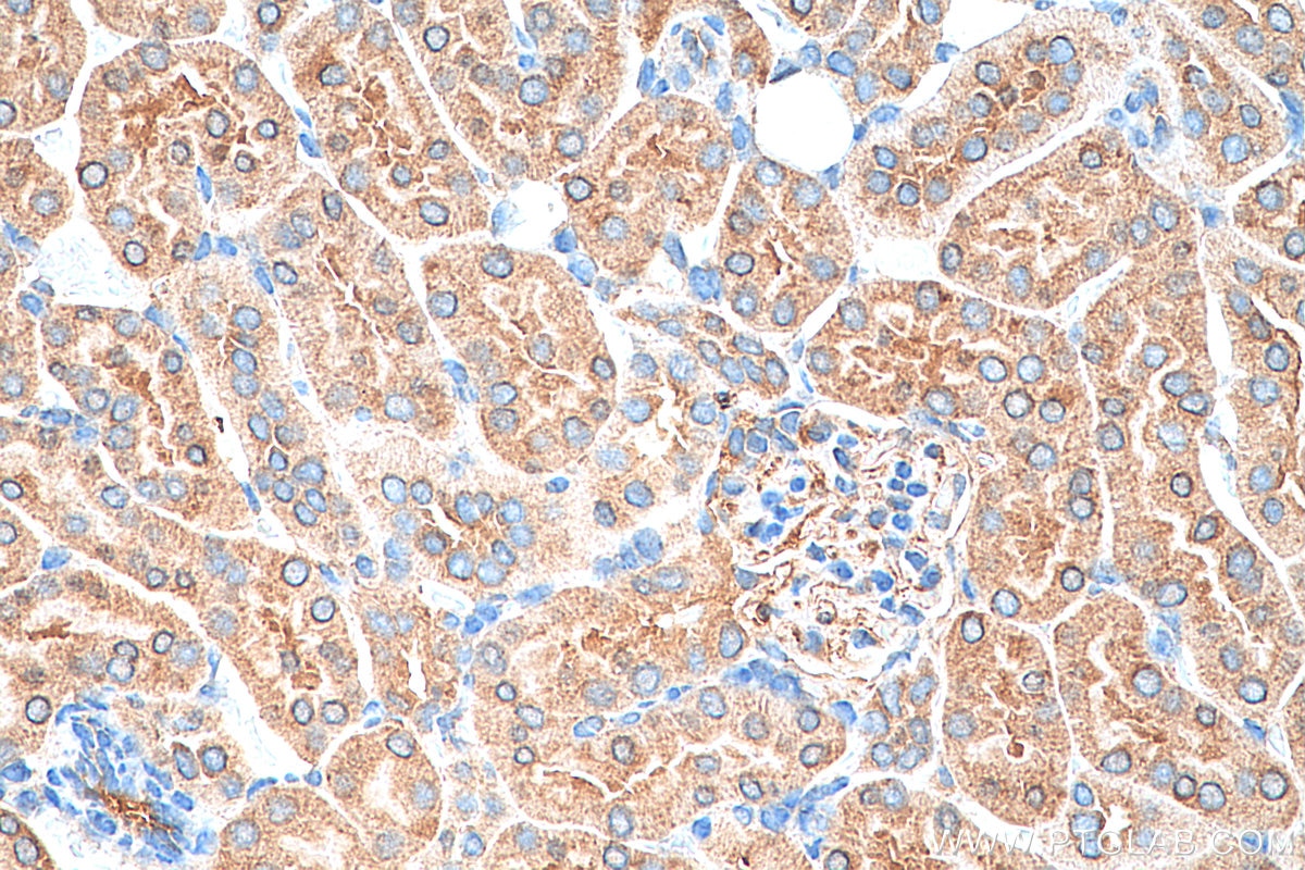 Immunohistochemistry (IHC) staining of mouse kidney tissue using Hamartin/TSC1 Polyclonal antibody (29906-1-AP)