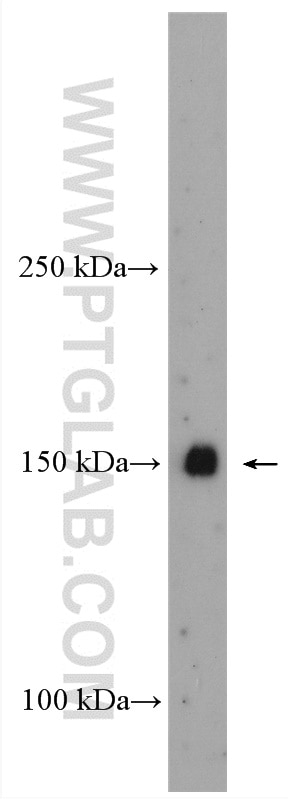 Western Blot (WB) analysis of mouse kidney tissue using Hamartin/TSC1 Polyclonal antibody (29906-1-AP)