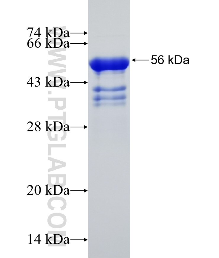 TSC1 fusion protein Ag31621 SDS-PAGE