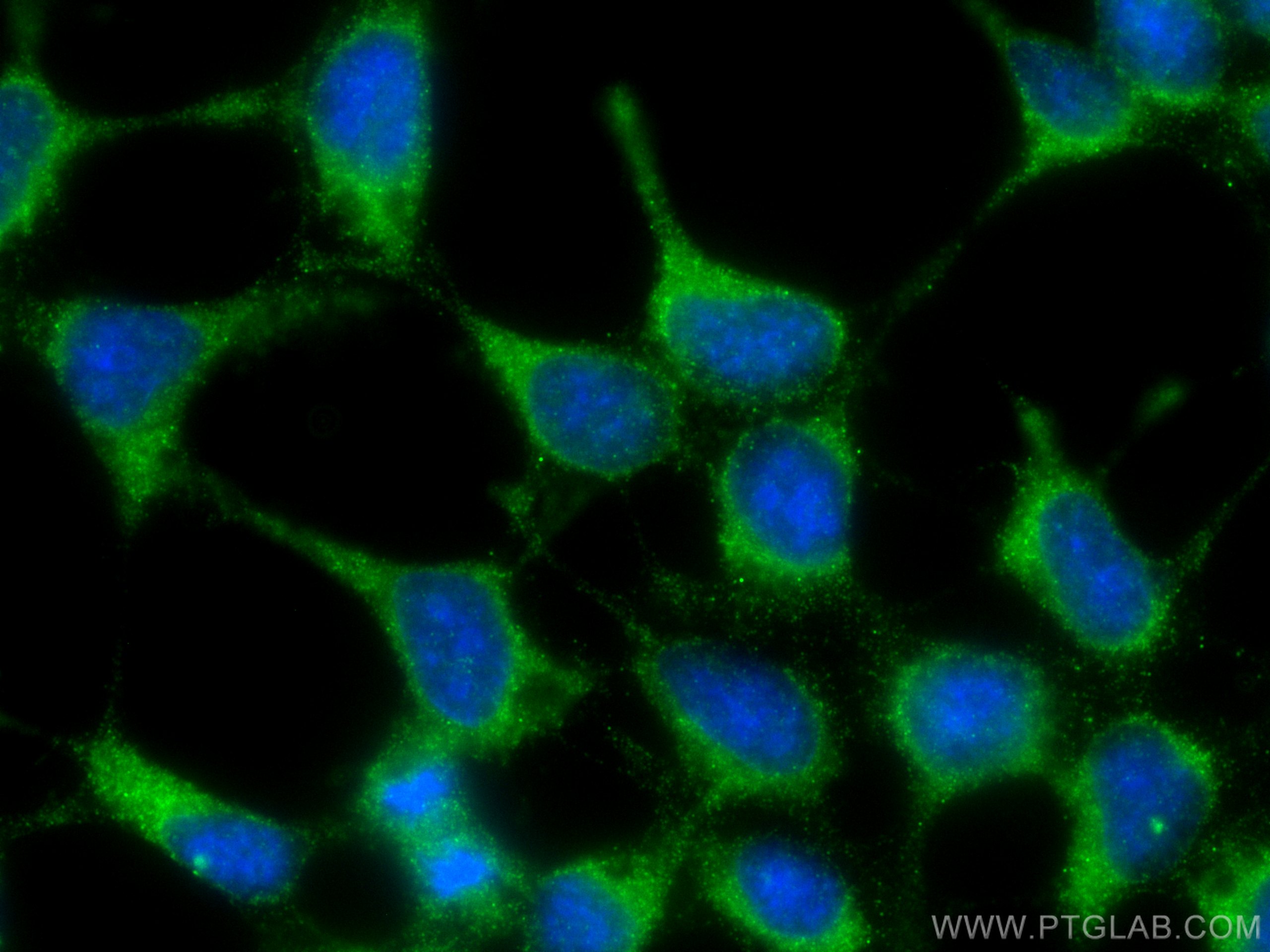 Immunofluorescence (IF) / fluorescent staining of HEK-293 cells using Tuberin Polyclonal antibody (24601-1-AP)