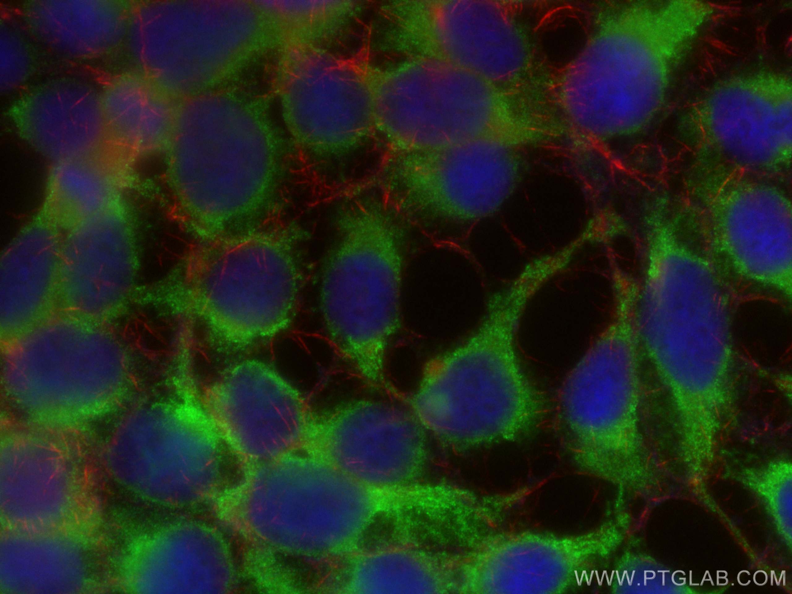 Immunofluorescence (IF) / fluorescent staining of HEK-293 cells using Tuberin Polyclonal antibody (24601-1-AP)