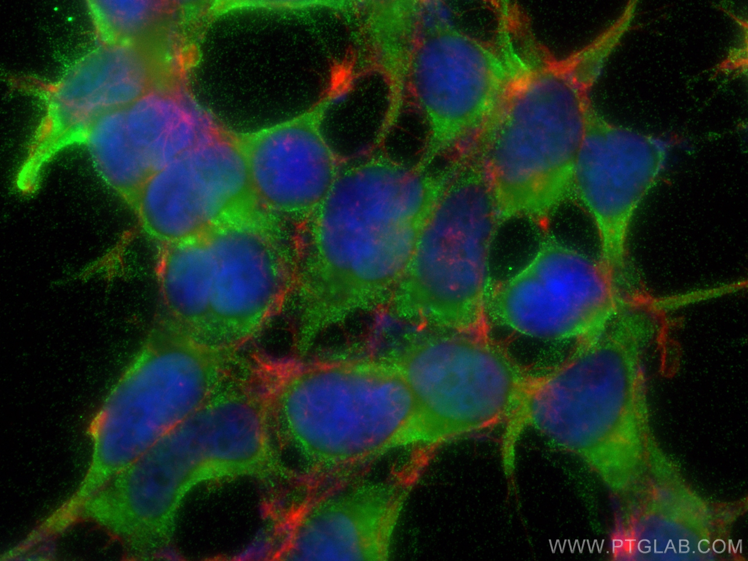 Immunofluorescence (IF) / fluorescent staining of HEK-293 cells using Tuberin/TSC2 Polyclonal antibody (24601-1-AP)