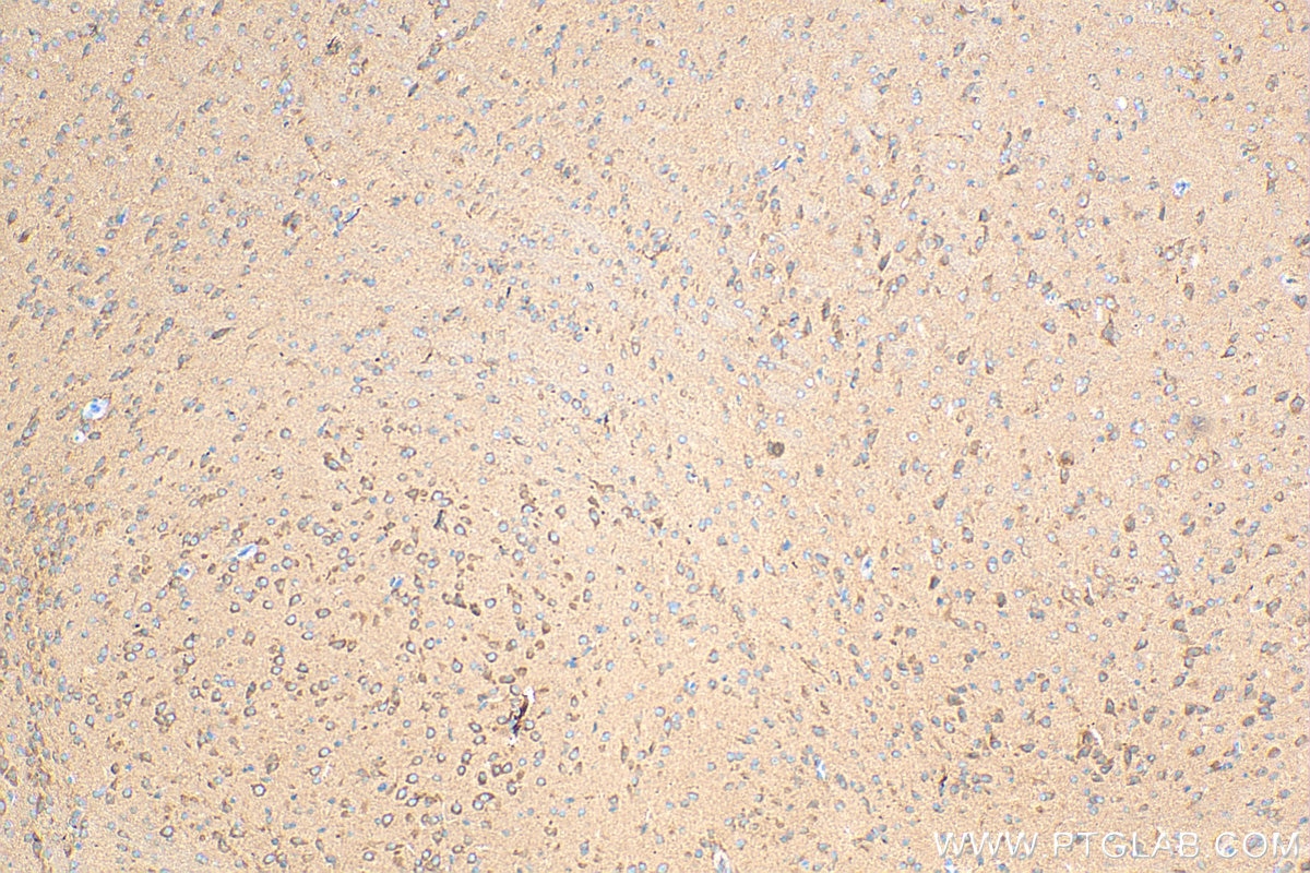 Immunohistochemistry (IHC) staining of mouse brain tissue using Tuberin Polyclonal antibody (24601-1-AP)