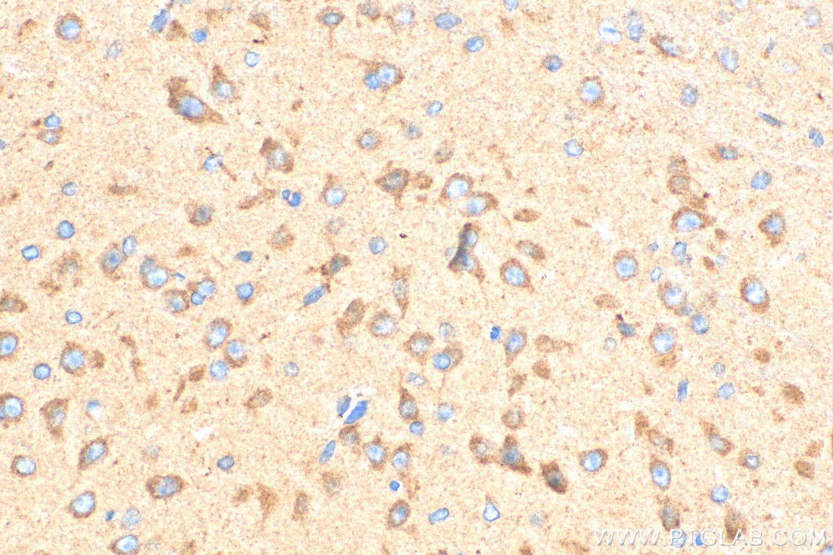 Immunohistochemistry (IHC) staining of mouse brain tissue using Tuberin Polyclonal antibody (24601-1-AP)