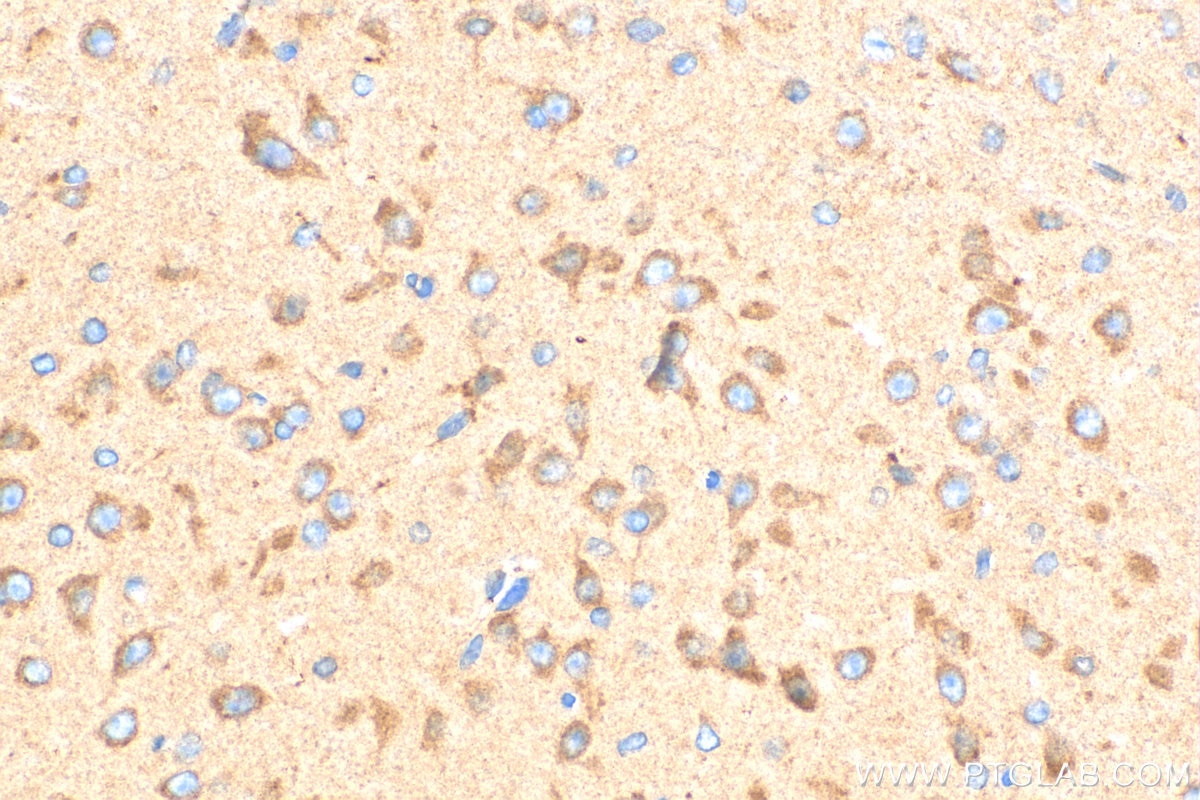 Immunohistochemistry (IHC) staining of mouse brain tissue using Tuberin Polyclonal antibody (24601-1-AP)