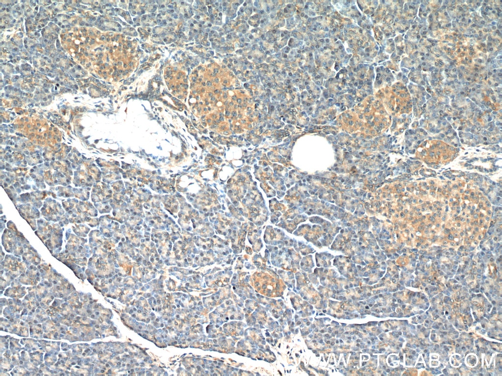 Immunohistochemistry (IHC) staining of human pancreas tissue using Tuberin Polyclonal antibody (24601-1-AP)