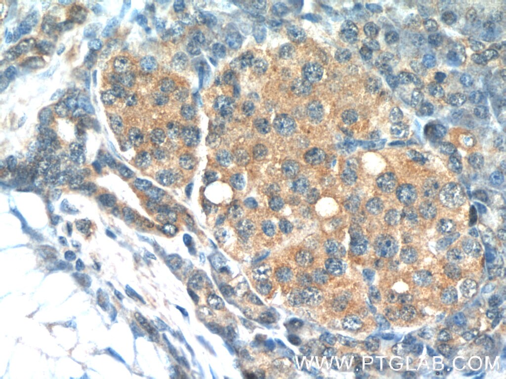 Immunohistochemistry (IHC) staining of human pancreas tissue using Tuberin Polyclonal antibody (24601-1-AP)