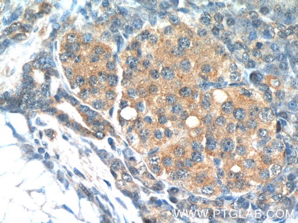 IHC staining of human pancreas using 24601-1-AP