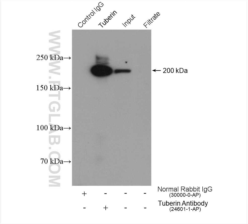 Immunoprecipitation (IP) experiment of SH-SY5Y cells using Tuberin Polyclonal antibody (24601-1-AP)