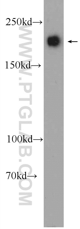 Tuberin Polyclonal antibody