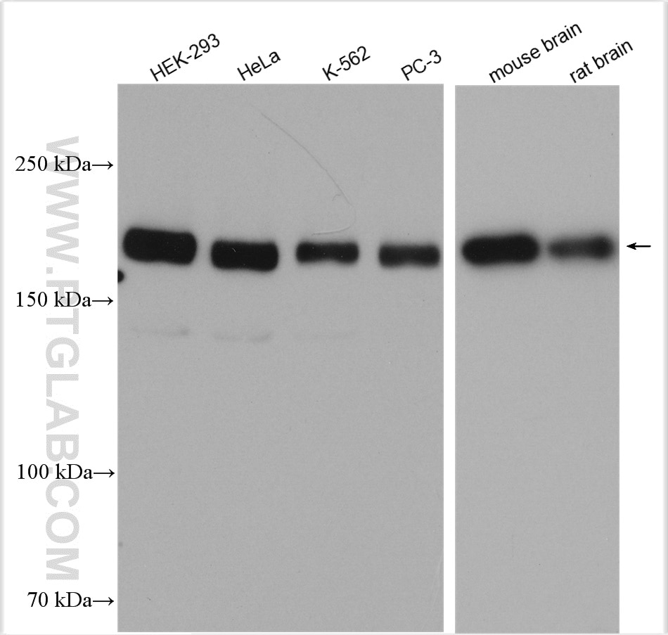 Western Blot (WB) analysis of various lysates using Tuberin Polyclonal antibody (24601-1-AP)
