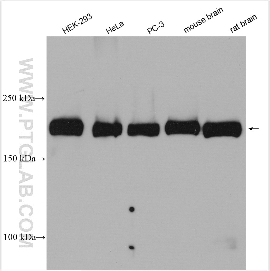 Western Blot (WB) analysis of various lysates using Tuberin Polyclonal antibody (24601-1-AP)