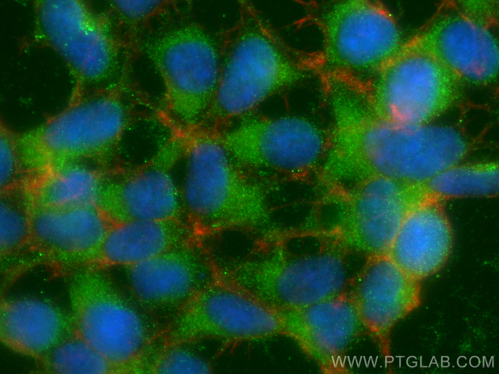 Immunofluorescence (IF) / fluorescent staining of HEK-293 cells using TSC2 Monoclonal antibody (68380-1-Ig)
