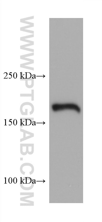 Tuberin/TSC2