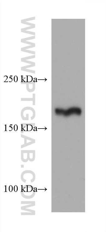 Western Blot (WB) analysis of MCF-7 cells using TSC2 Monoclonal antibody (68380-1-Ig)