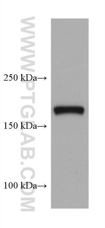 Western Blot (WB) analysis of PC-3 cells using TSC2 Monoclonal antibody (68380-1-Ig)
