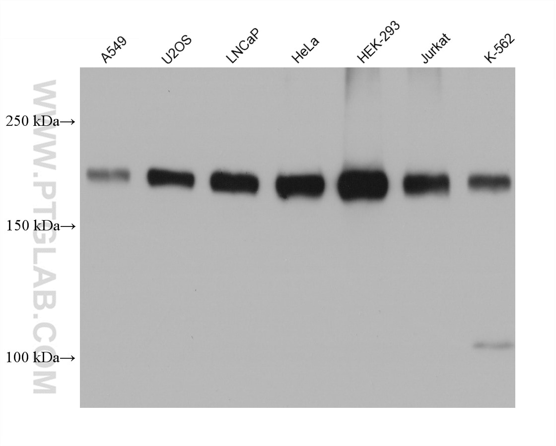 Western Blot (WB) analysis of various lysates using TSC2 Monoclonal antibody (68380-1-Ig)