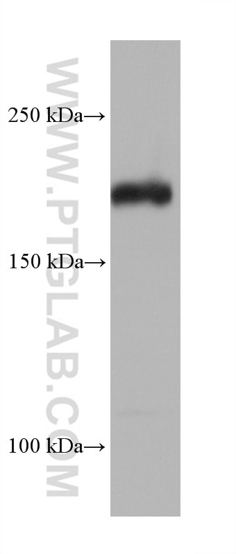 Western Blot (WB) analysis of NIH/3T3 cells using TSC2 Monoclonal antibody (68380-1-Ig)