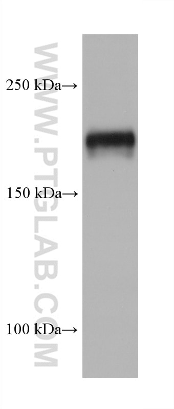 Western Blot (WB) analysis of HSC-T6 cells using TSC2 Monoclonal antibody (68380-1-Ig)