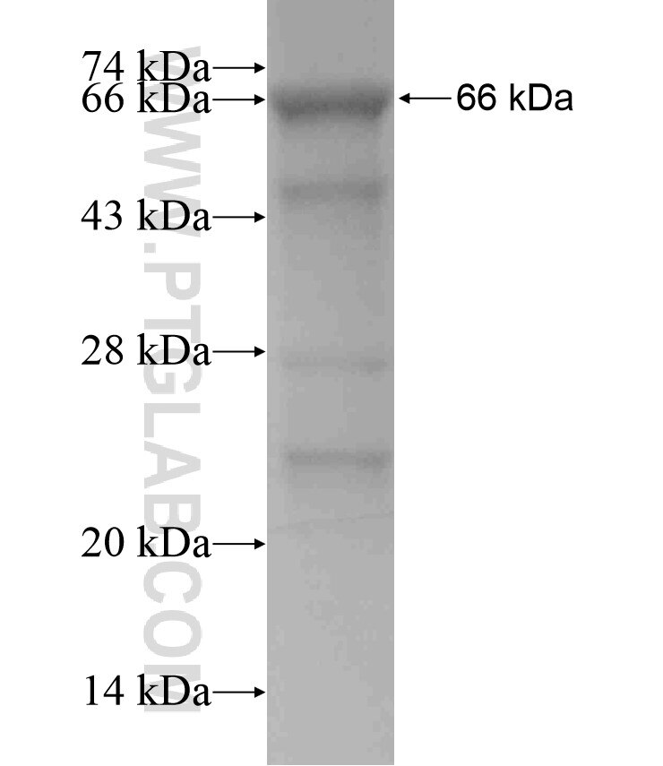 TSC2 fusion protein Ag18133 SDS-PAGE