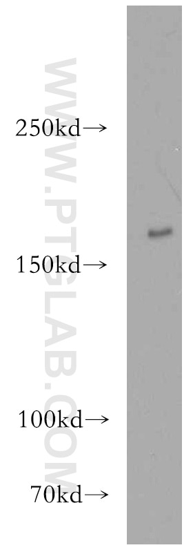 Tuberin-Specific Polyclonal antibody