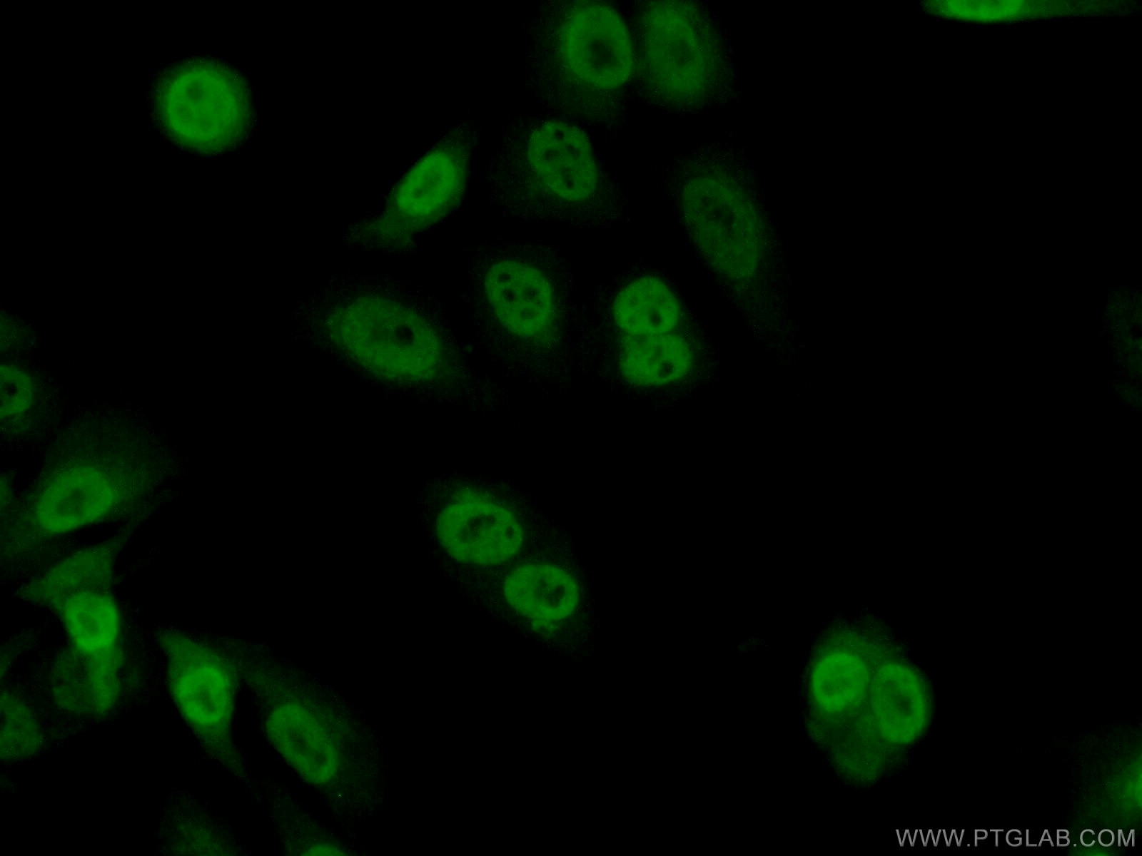Immunofluorescence (IF) / fluorescent staining of A549 cells using TSC22D1 Polyclonal antibody (10214-1-Ig)