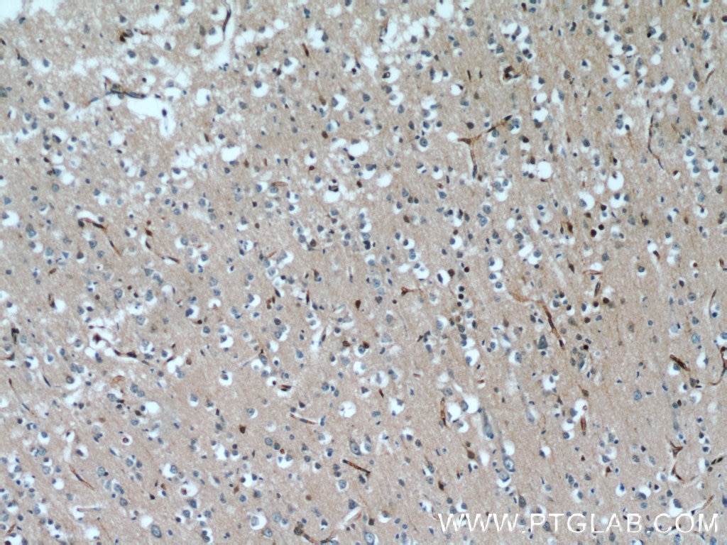 Immunohistochemistry (IHC) staining of human brain tissue using TSC22D1 Polyclonal antibody (10214-1-Ig)