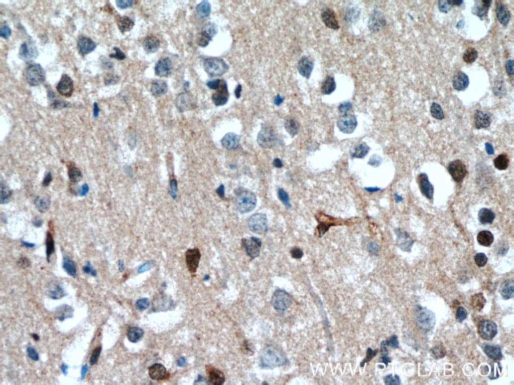 Immunohistochemistry (IHC) staining of human brain tissue using TSC22D1 Polyclonal antibody (10214-1-Ig)