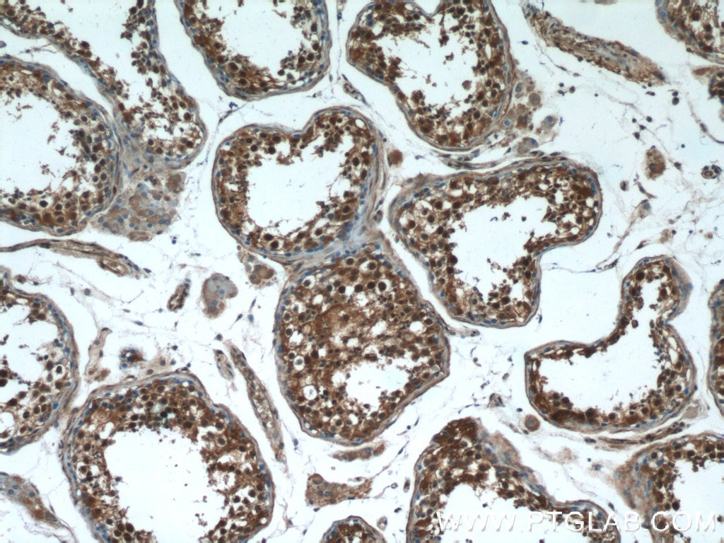 Immunohistochemistry (IHC) staining of human testis tissue using TSC22D1 Polyclonal antibody (10214-1-Ig)