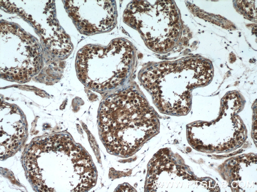 IHC staining of human testis using 10214-1-Ig