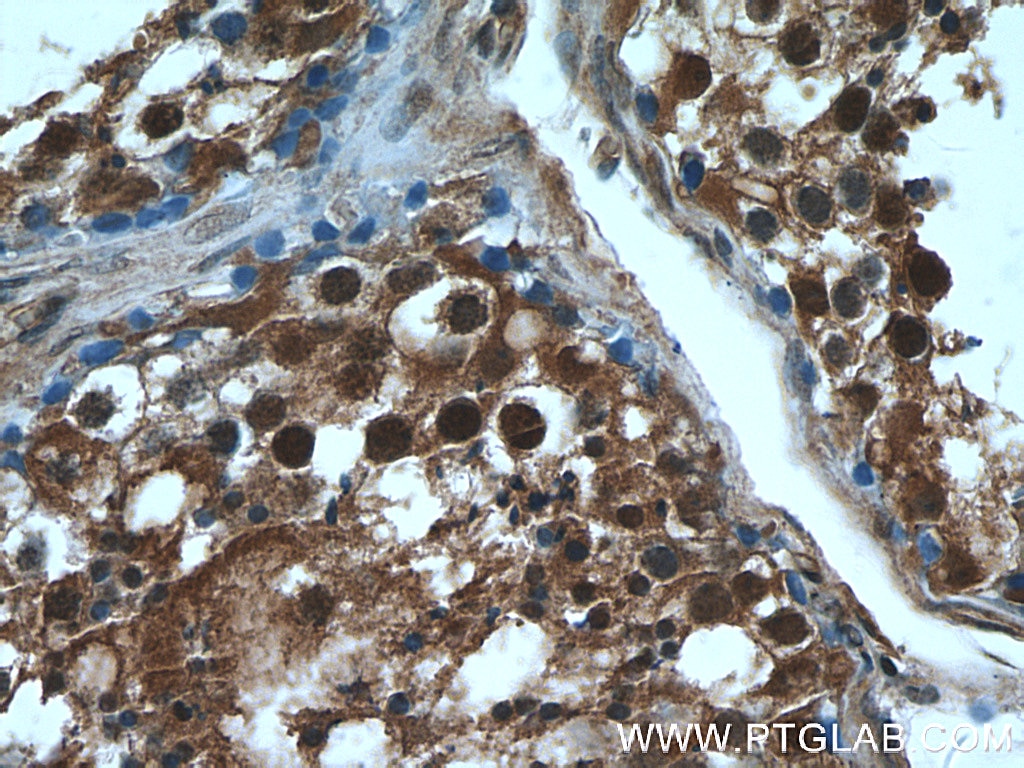 IHC staining of human testis using 10214-1-Ig