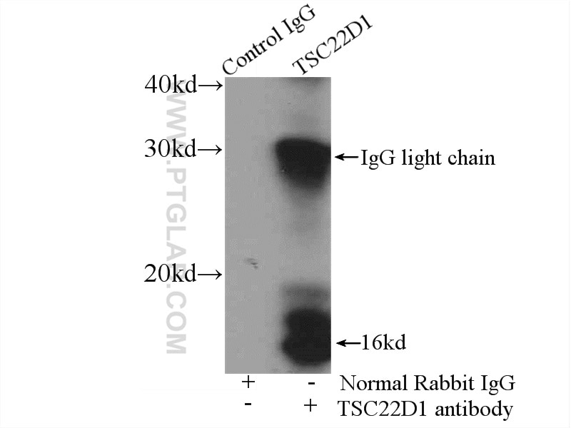 Immunoprecipitation (IP) experiment of rat brain tissue using TSC22D1 Polyclonal antibody (10214-1-Ig)