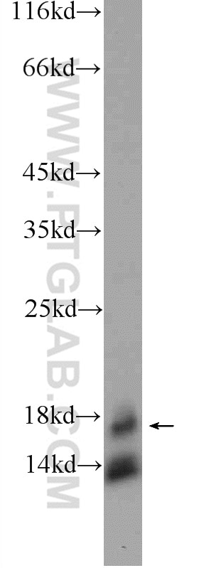 Western Blot (WB) analysis of rat brain tissue using TSC22D1 Polyclonal antibody (10214-1-Ig)