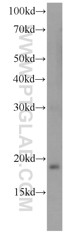 Western Blot (WB) analysis of A549 cells using TSC22D1 Polyclonal antibody (10214-1-Ig)