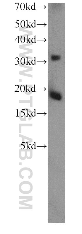 Western Blot (WB) analysis of human brain tissue using TSC22D1 Polyclonal antibody (10214-1-Ig)