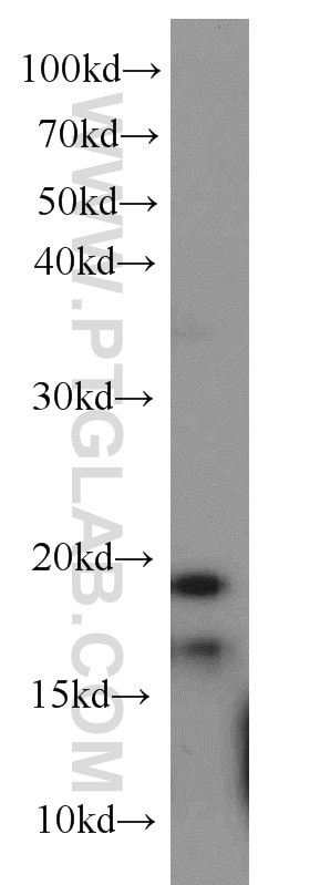 TSC22D1