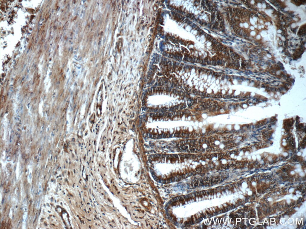 Immunohistochemistry (IHC) staining of human colon tissue using TSC22D2 Polyclonal antibody (25418-1-AP)