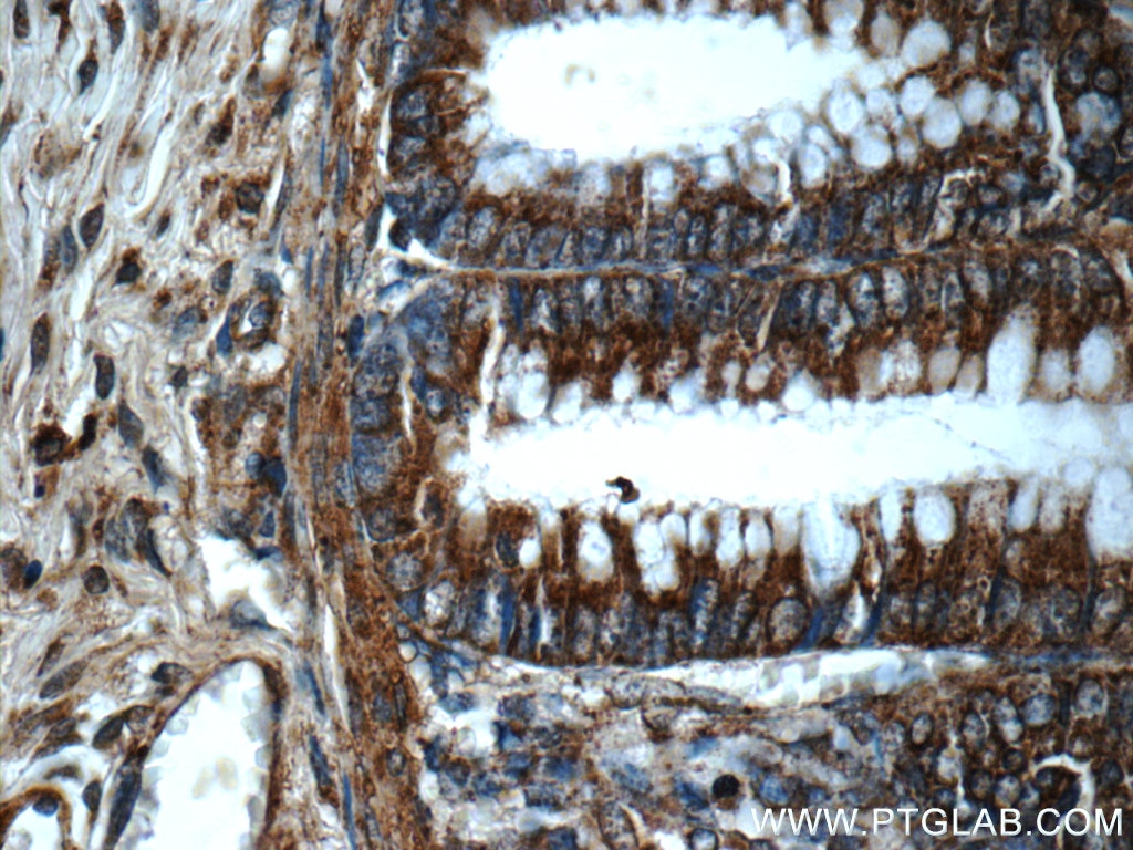 Immunohistochemistry (IHC) staining of human colon tissue using TSC22D2 Polyclonal antibody (25418-1-AP)